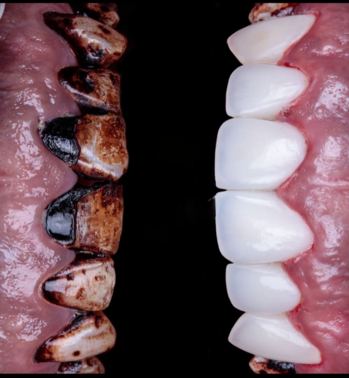 Patient dental smile case 8 at Care Plus Dental Clinic in Hurghada