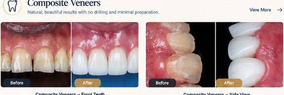 Cosmetic Dentistry dental care in Hurghada